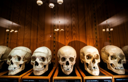 La collection de crânes d'un anatomiste autrichien au Mütter Museum de Philadelphie, le 20 août 2025 en Pennsylvanie - Matthew Hatcher (AFP) La collection de crânes d'un anatomiste autrichien au Mütter Museum de Philadelphie, le 20 août 2025 en Pennsylvanie - Matthew Hatcher (AFP)